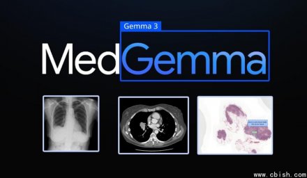 谷歌发布MedGemma 1.5，显著提升CT与MRI影像解读准确率