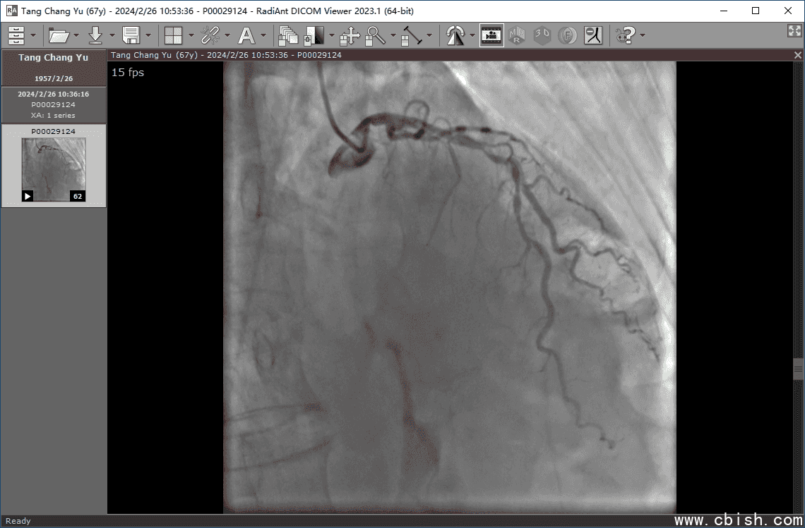 心脏造影视频播放器 破解版 