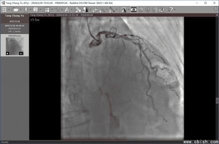 RadiAnt DICOM Viewer（2025.1）心脏造影视频播放器官方版本 | 专业医学影像浏览工具