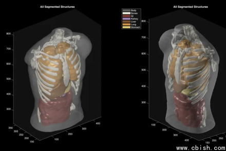 Midjourney推出全身超声扫描仪，跨界医疗影像